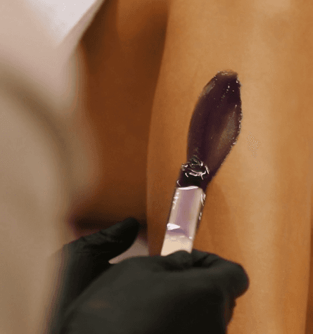 ДЕПИЛЯЦИЯ ВОСКОМ LYCON (Ликон)